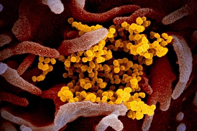 Cuộc chiến sinh tử giữa virus Sars-Cov-2 và hệ thống miễn dịch