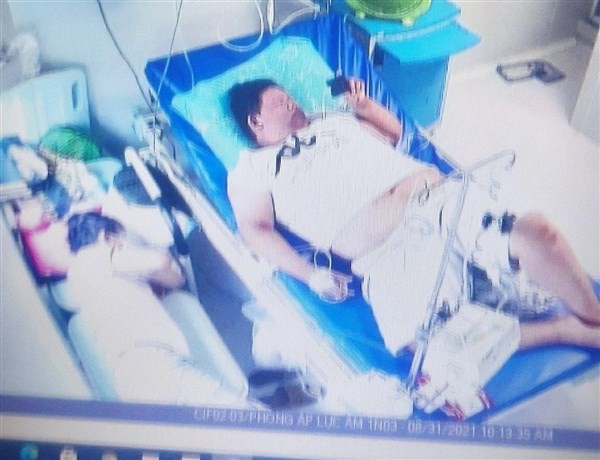 Bệnh nhi béo phì từng rơi vào nguy kịch khi mắc Covid-19. Ảnh: Bệnh viện Nhi đồng TP Hồ Chí Minh.
