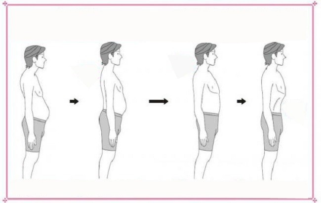 Bác sĩ Masashi Kawamura đưa ra “phương pháp đi bộ 3 ngày cho bụng nhỏ” để nhanh chóng “giảm cân” cho “bụng bia” của các quý ông. (Ảnh: Internet)