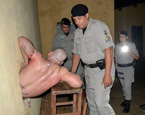 Gã tù nhân với cơ thể xây xát, một bên xương sườn bị gãy