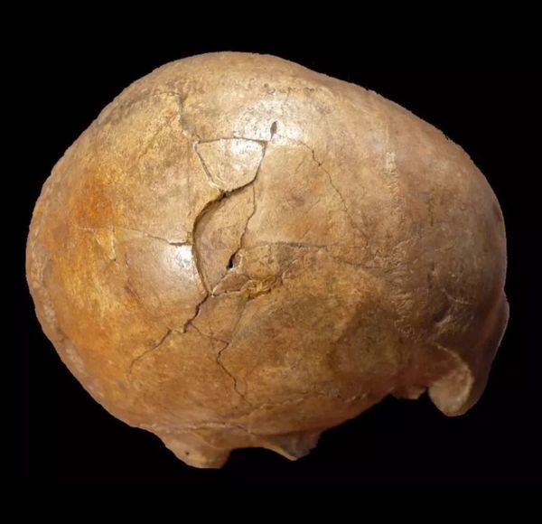 Vụ án hộp sọ 33.000 năm tuổi nứt vỡ đã có lời giải đáp.