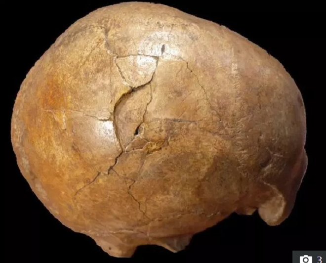 Hộp sọ 33.000 năm tuổi bị nứt vỡ hé lộ câu chuyện đáng sợ